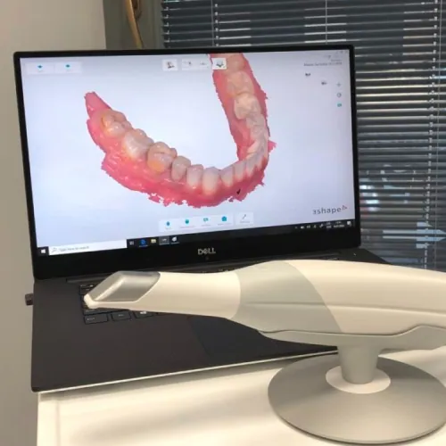 Scanner intraoral